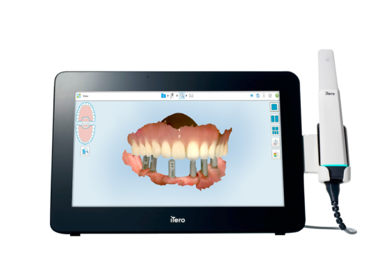 V2 Cong Nghe Nieng 1
