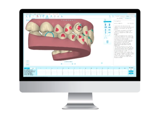 V2 Cong Nghe Nieng 2
