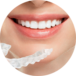 NIỀNG RĂNG INVISALIGN