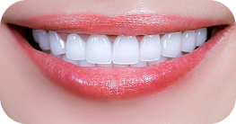 Cute & Youthful Style