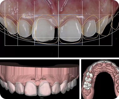 Digital Smile Design (Dsd) Technology