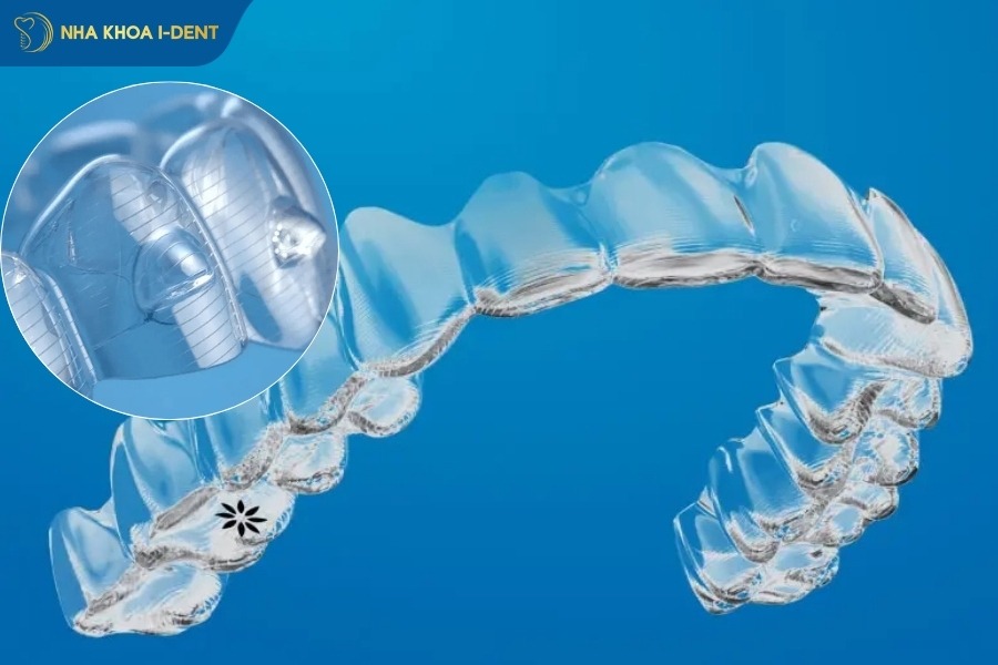 răng invisalign có hiệu quả không