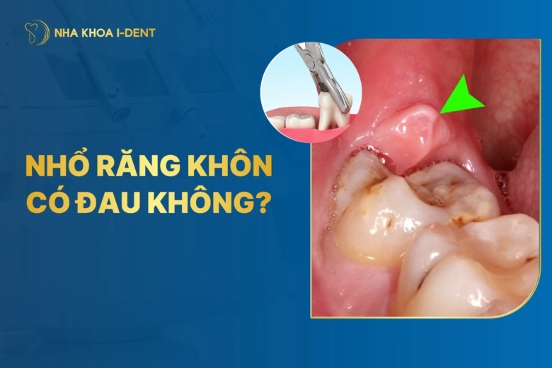 Nhổ răng khôn có đau không? Những lưu ý cần biết
