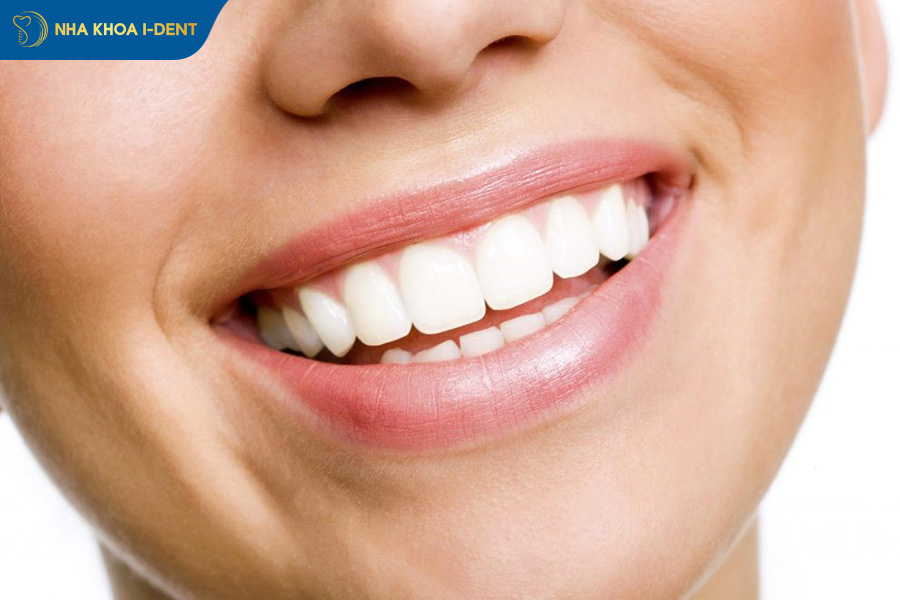 cách làm răng đều không cần niềng