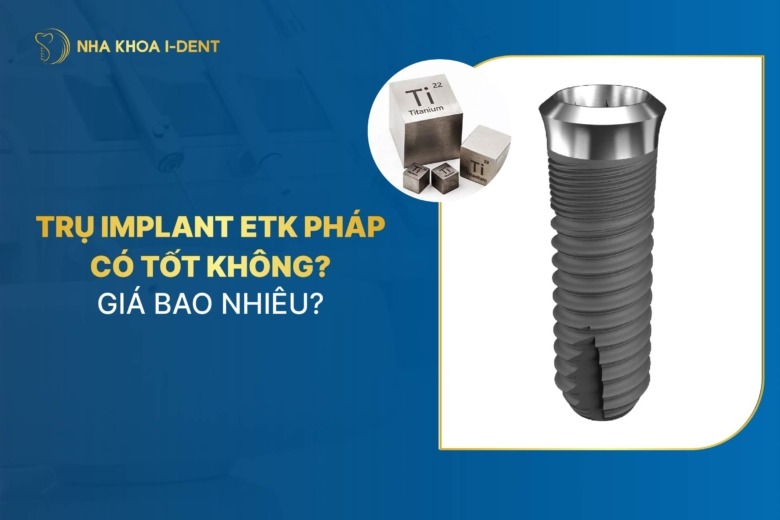 Đánh giá trụ Implant ETK Pháp: Chất lượng và giá
