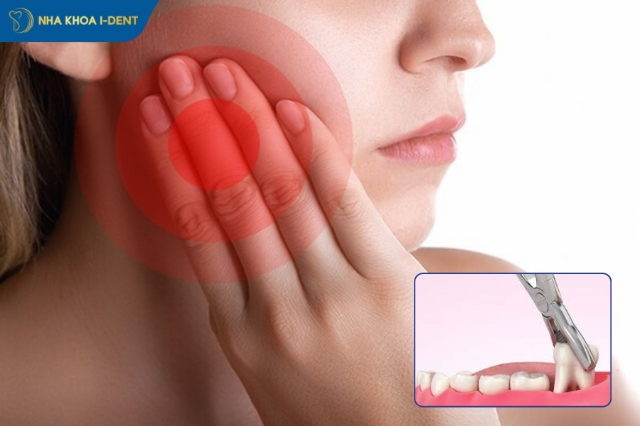 nhổ răng khôn đau bao lâu