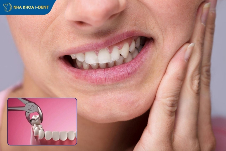 nhổ răng khôn đau không