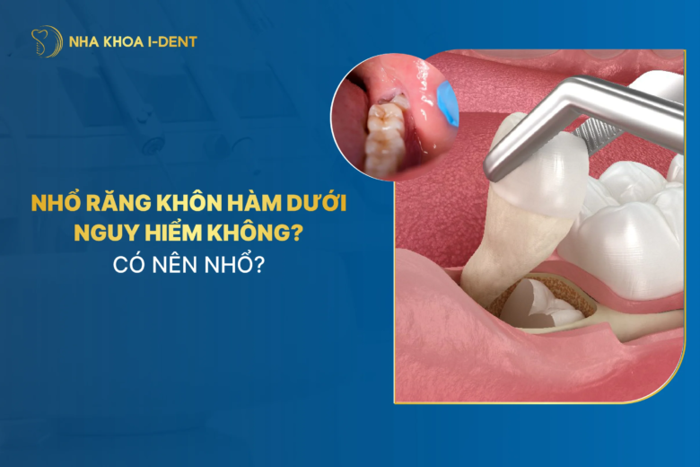 Nhổ răng khôn hàm dưới nguy hiểm không? Có nên nhổ?