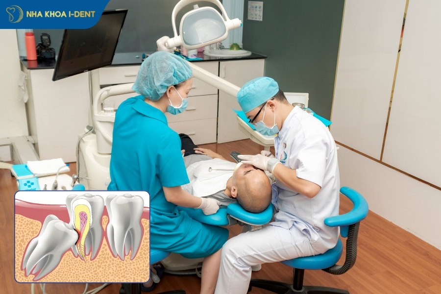 nhổ răng khôn hàm dưới