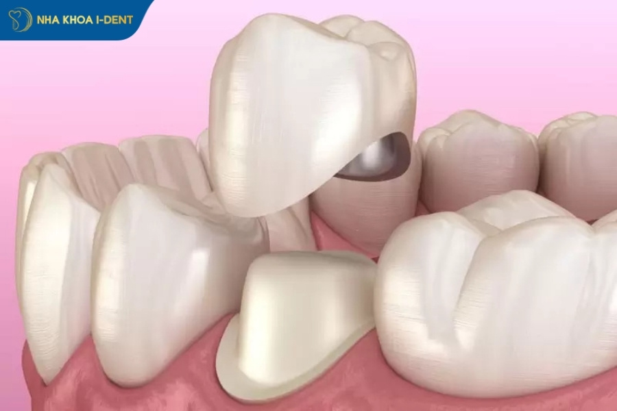 nhổ răng số 7 hàm trên có nguy hiểm không