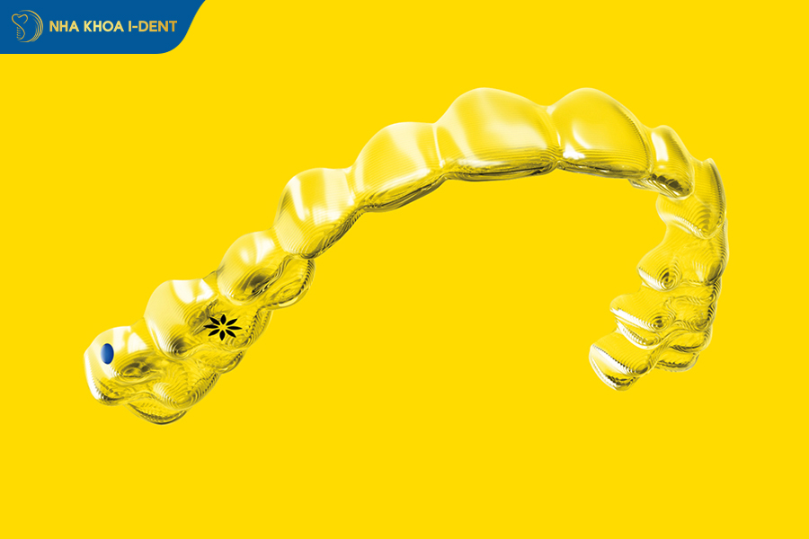 niềng răng tháo lắp giá bao nhiêu