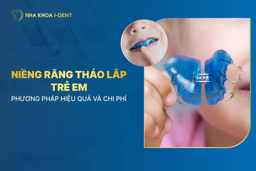 Niềng răng tháo lắp trẻ em là gì? Các phương pháp và chi phí điều trị