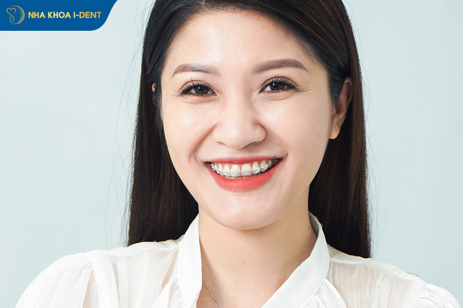 niềng răng trả góp tại nha khoa ident