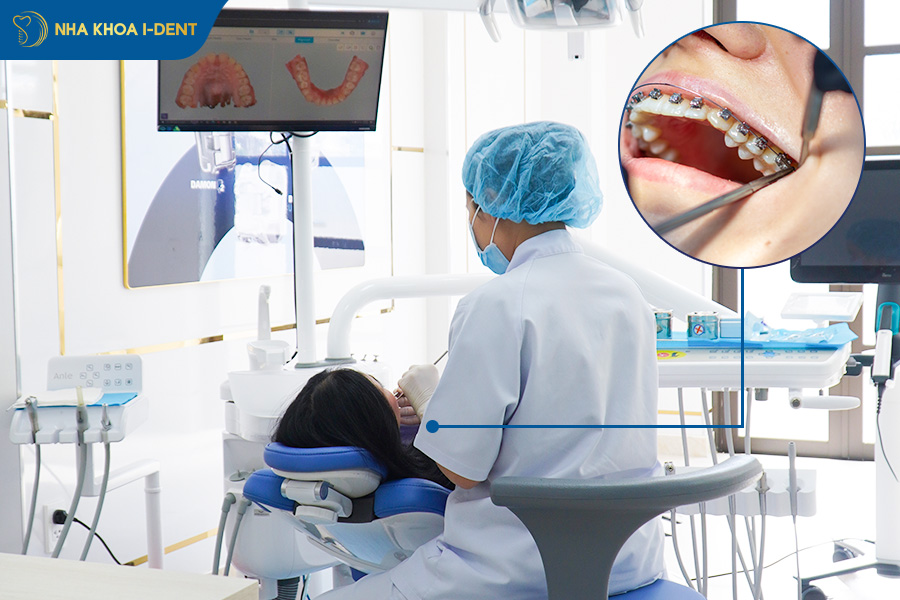 tháo niềng răng có đau không