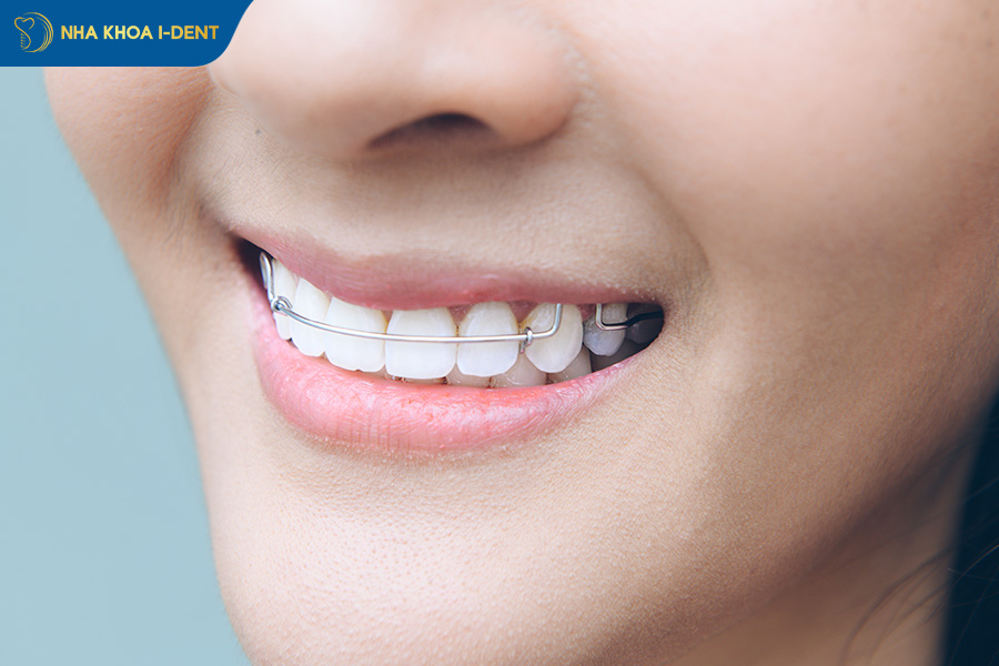 tháo niềng răng có đau không