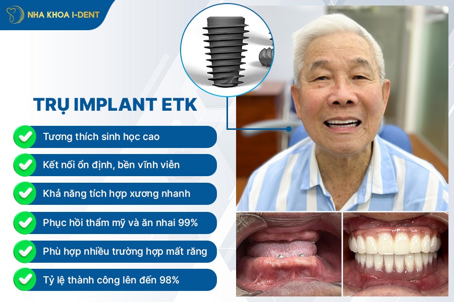 trụ etk tương thích sinh học cao