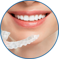Invisalign Express