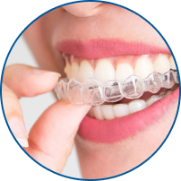 Invisalign Moderate