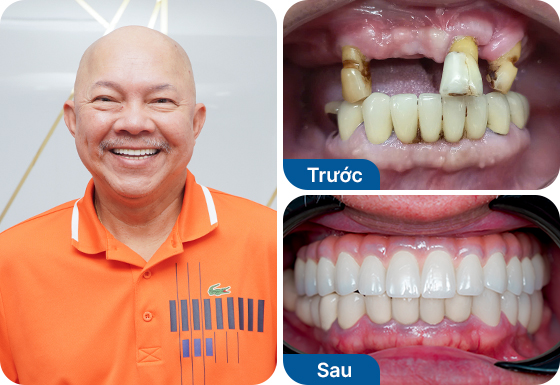 Chú Nguyễn Văn Huy Chú Nguyễn Văn Huy