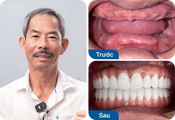 Chú Ngô Văn Út Chú Ngô Văn Út