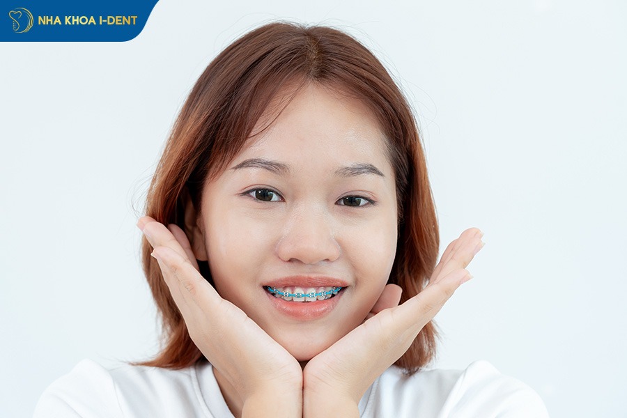 20 tuổi niềng răng bao lâu