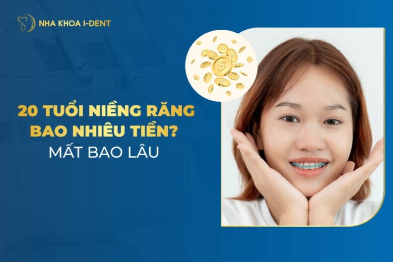 Giá Niềng Răng 20 Tuổi Bao Nhiêu Tiền? Niềng Mất Bao Lâu?