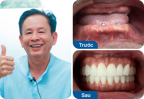 Chú Nguyễn Minh Hào Chú Nguyễn Minh Hào