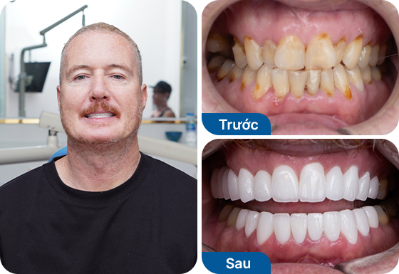 Chú Tim Baker Chú Tim Baker