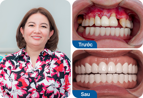 Cô Ngọc Quyên Cô Ngọc Quyên