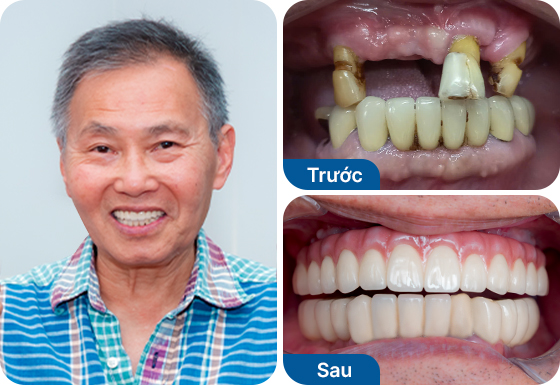 Chú Tony Cường Hoàng Chú Tony Cường Hoàng