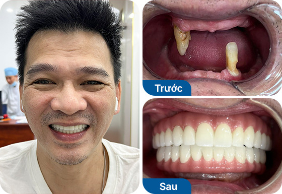 Chú Trần Hải Linh