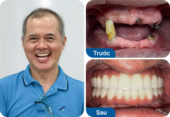 Chú Nguyễn Trần Thảo Linh