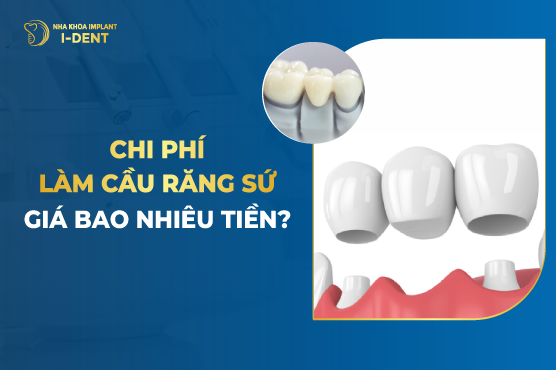 Chi Phí Làm Cầu Răng Sứ Giá Bao Nhiêu Tiền?