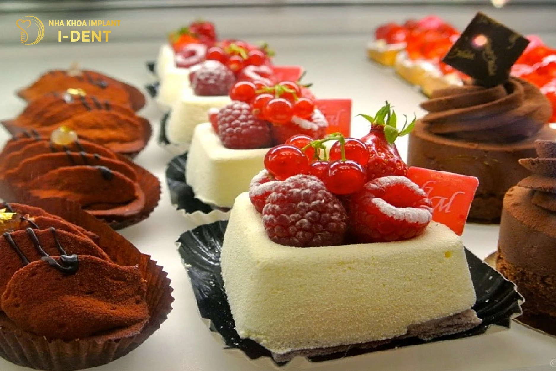 niềng răng có kiêng gì không