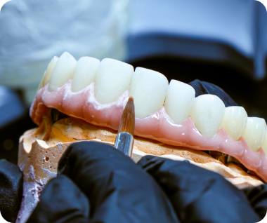 Multilayer Fabrication Technique