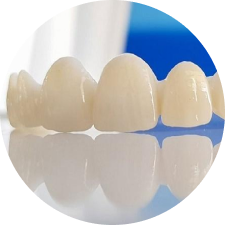 Multilayer DDBio All-Ceramic Crown