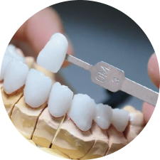 Lava Plus All-Ceramic Crown