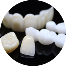 Multilayer Cercon HT All-Ceramic Crown