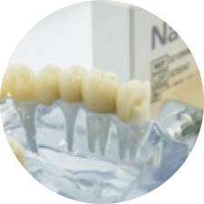 Nacera 9 Max All-Ceramic Crown