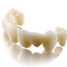 Lava Esthetic All-Ceramic Crown