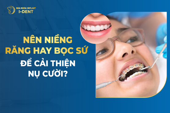 Nên Niềng Răng Hay Bọc Sứ Để Cải Thiện Nụ Cười?
