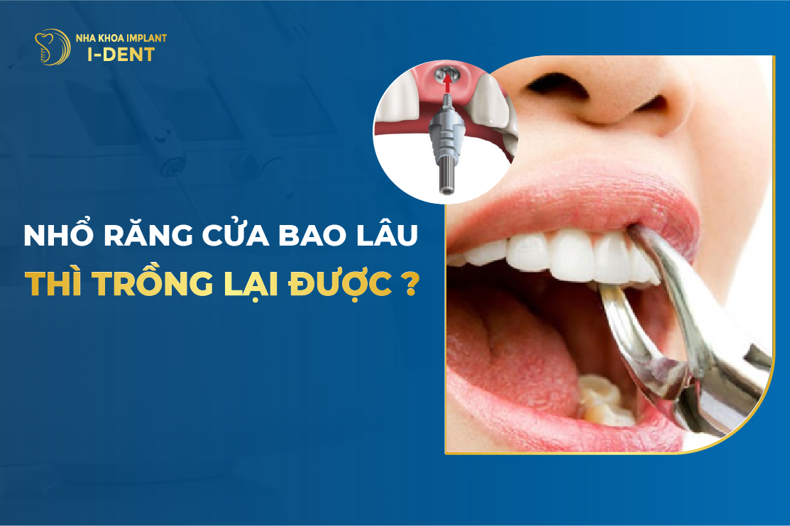 Nho Rang Cua Bao Lau Thi Trong Lai Duoc