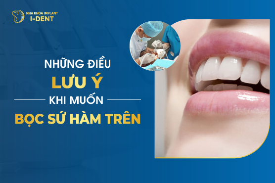 Những Lưu Ý Khi Muốn Bọc Sứ Hàm Trên