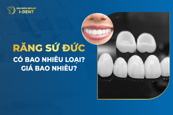 Răng Sứ Đức Có Bao Nhiêu Loại? Giá Bao Nhiêu?