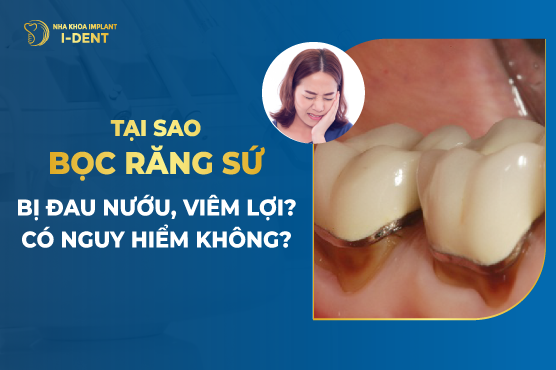 Viêm Lợi Sau Khi Bọc Răng Sứ Do Đâu? Cách Khắc Phục