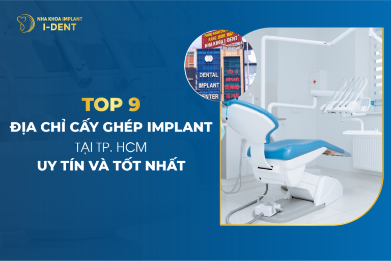 Trồng răng implant ở đâu? Top 9 địa chỉ cấy ghép implant tốt TPHCM Trồng răng implant ở đâu? Top 9 địa chỉ cấy ghép implant tốt TPHCM