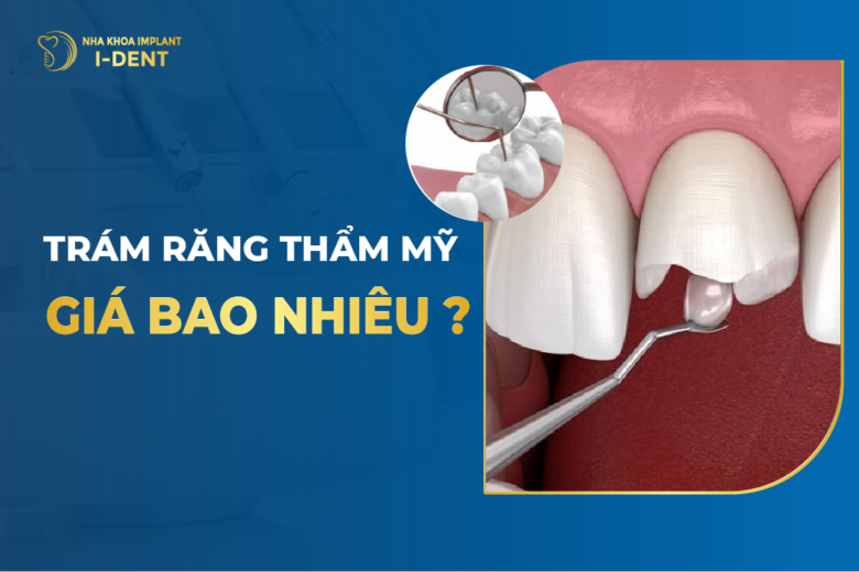 Giá Trám Răng Sâu Bao Nhiêu Tiền? Bảng Giá Trám Răng 2026