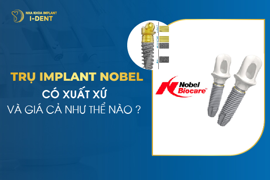 Trụ Implant Nobel Có Xuất Xứ Và Giá Cả Như Thế Nào?