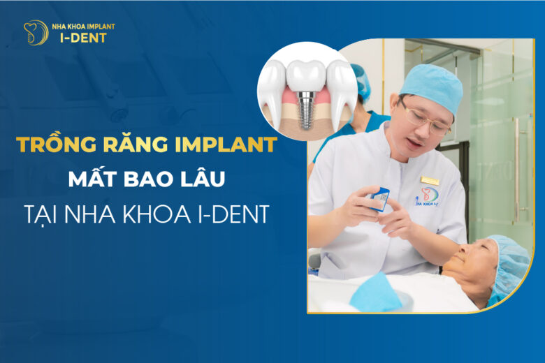 Trồng Răng Implant Mất Bao Lâu? Quy Trình Chi Tiết 3 6 Tháng