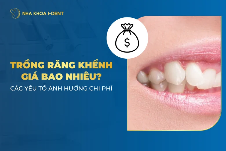 Làm Răng Khểnh Giá Bao Nhiêu Tiền? Phương Pháp Nào?